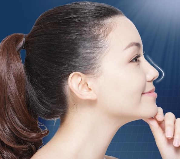 假体隆鼻是什么？有什么利弊呢？